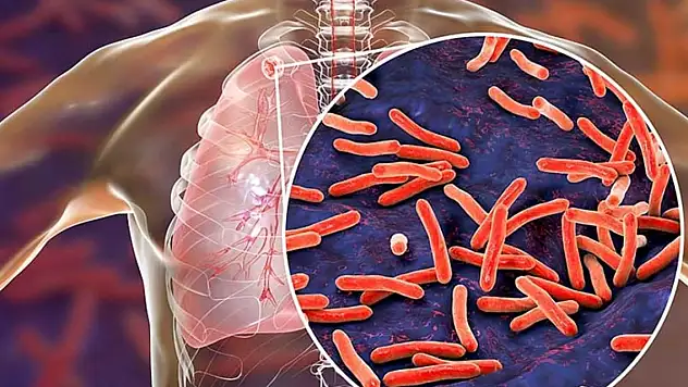 Dünyada her dakika 3 kişi bu hastalıktan hayatını kaybediyor