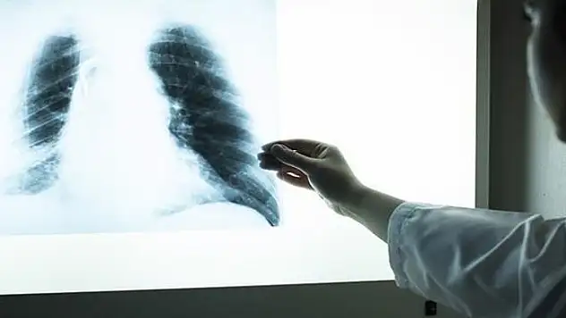 Yeni kanser ilaçları yüz güldürüyor