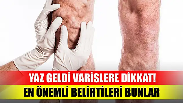 Yaz geldi varislere dikkat!  Varisin en önemli belirtileri bunlar, görünce tedbir alın!