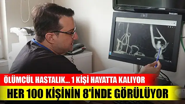 Ölümcül hastalık... Her 100 kişinin 8'inde görülüyor 1'i hayatta kalıyor