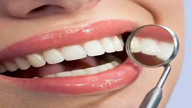 Türkiye'de en yaygın ağız sağlığı sorunu diş çürüğü