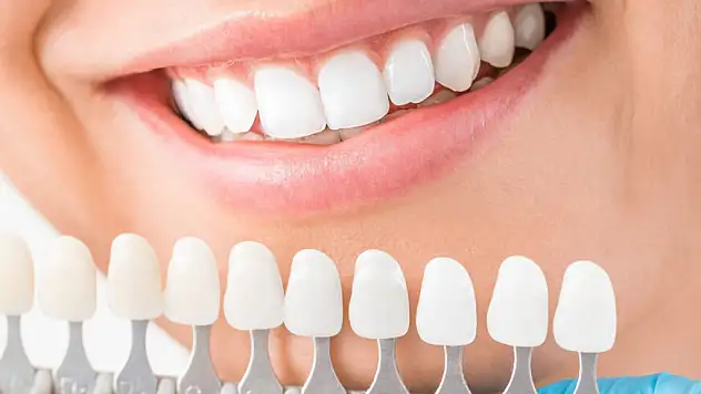 En İyi Zirkonyum Diş Kaplama Fiyatları Nerededir?