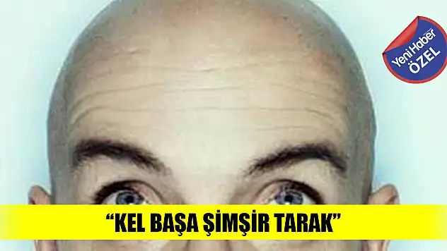 Kel başa şimşir tarak!