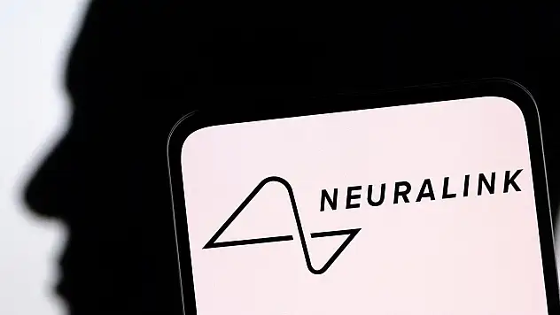Elon Musk'un Neuralink'i beyin implantı için insan denemesine başlıyor