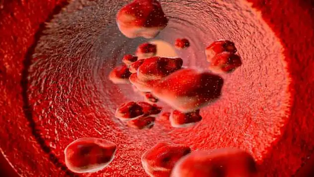 Her 16 kişiden biri nadir hastalıklara sahip!