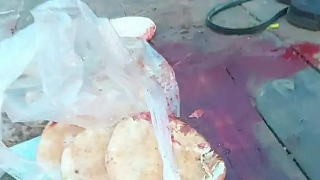 İsrail ekmek almak isteyen sivilleri vurdu