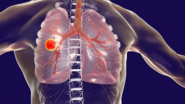 Hedeflerin gerisinde kalındı! Halen dünyanın ikinci ölümcül bulaşıcı hastalığı