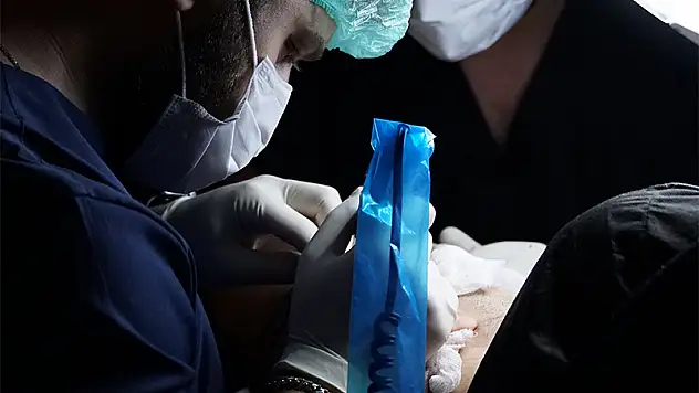 Murat Makascı Klinik Kök Hücreli Saç Ekimi Yapıyor