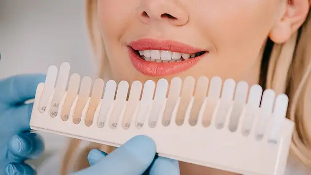 Diş Beyazlatma İşlemi Nedir, Nasıl Yapılır?