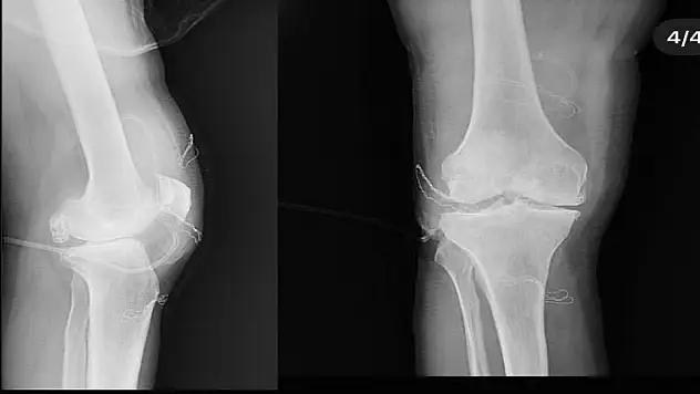 Dizden çıkan eklem fareleri şaşırttı