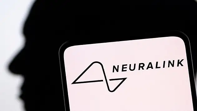 Elon Musk açıkladı: İlk kez bir insana beyin çipi yerleştirildi