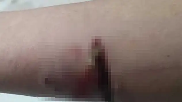 Başıboş köpeklerin saldırısına uğrayan çocuk yaralandı