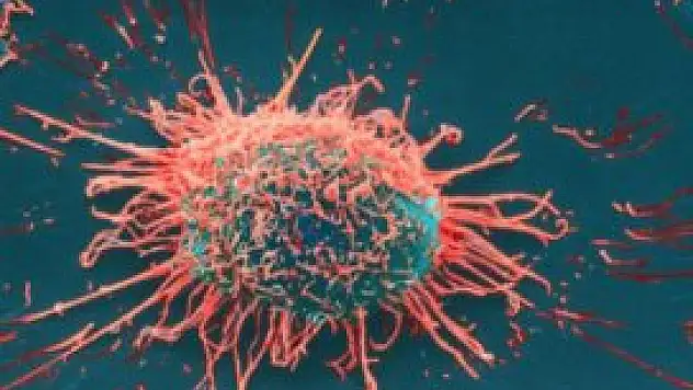 Yanlış beslenme, 'meme' kanserini tetikliyor