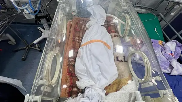 Gazze'de açlıktan ölen çocukların sayısı 10'a yükseldi