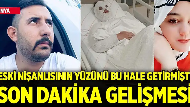 Konya'da eski nişanlısını bu hale getirmişti... Türkiye'nin konuştuğu olayda son dakika gelişmesi!