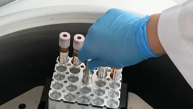 Türkiye'de 5 binden fazla kök hücre nakli yapıldı