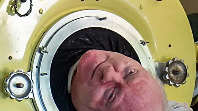 Demir akciğerli adam: Paul Alexander 78 yaşında hayatını kaybetti