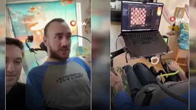 Beyin çipi takılan felçli hasta düşünce gücüyle satranç oynadı