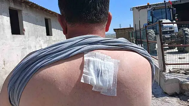 Muhtarlık seçimi kavgası kanlı bitti: 4'ü ağır 23 yaralı