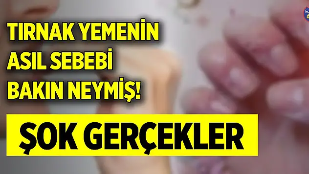 Tırnak yemenin asıl sebebi bakın neymiş! Şok gerçekler