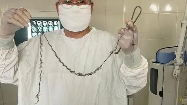 Çocuğun beyninden saç çıktı