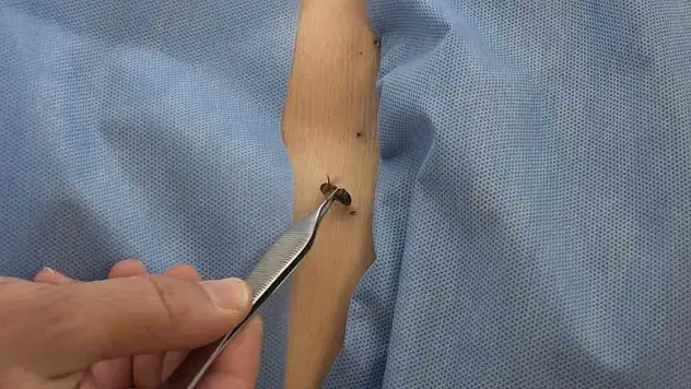 5 bin yıllık tedavi... Hastalara şifa dağıtıyor