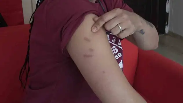 Kadın antrenör turnuvada darp edildi