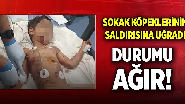 Adana'da 5 yaşındaki çocuk sokak köpeklerinin saldırısına uğradı! Durumu ağır...