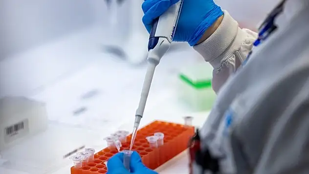 Yeni corona mı? DSÖ'den, M çiçeği virüsü uyarısı...