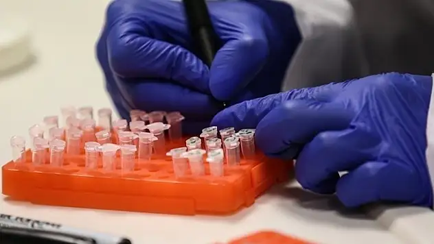 Maymun çiçeği virüsü Avrupa'ya sıçradı