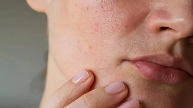 Konya'daki uzmandan uyarı! Mevsim geçişlerine dikkat