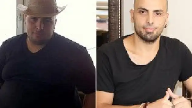'Gastrik by-pass' ameliyatı ile 90 kilo verdi