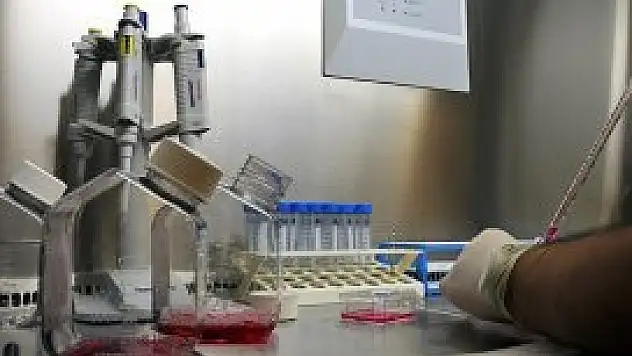 10 milyon kişinin kolesterolü yüksek