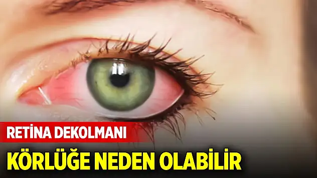Uzman isim uyardı: Karanlık bir perde gibi... Körlüğe neden olabilir