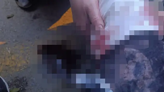 Evine dönen akademisyene köpekler saldırdı