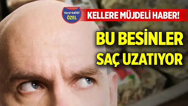 Kellere müjdeli haber! Bu besinler saç uzatıyor