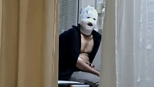 Benzinle sobayı tutuştururken yüzü yandı