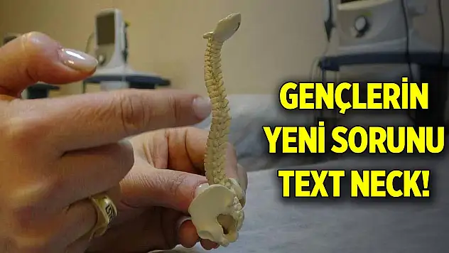 Gençlerin yeni sorunu text neck!