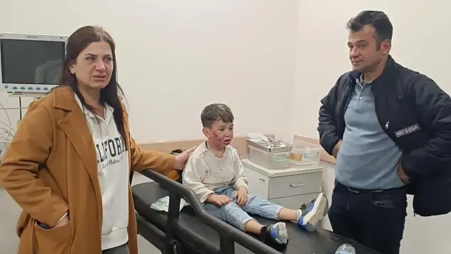 Oyun parkında başıboş köpeğin saldırısına uğradı