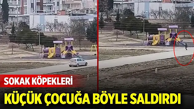 Sokak köpekleri küçük çocuğa böyle saldırdı