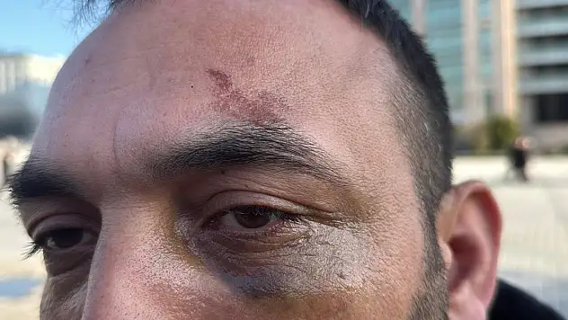 Sevgilisinin evinde dehşeti yaşadı!