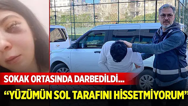 Sokak ortasında darbedildi... Artık yüzümün sol tarafını hissetmiyorum
