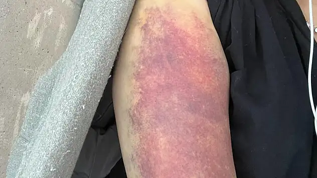 Eski sevgili dehşeti