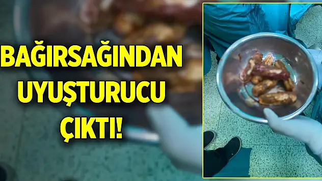 Bağırsağından uyuşturucu çıktı!