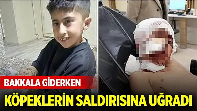 Bakkala giderken köpeklerin saldırısına uğrayan Murat, ağır yaralandı