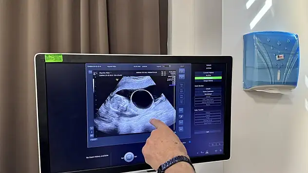 Konya'da anne karnındaki tek yumurta ikizi ameliyat edildi