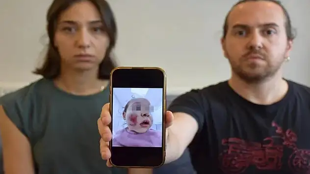 2 yaşındaki çocuk kreşte 2 çocuk tarafından dövüldü: Yüzü parçalanmış