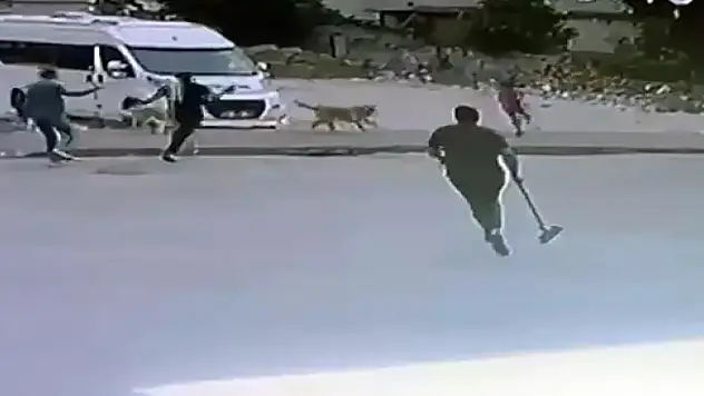 Sokak köpekleri çocuğa saldırdı
