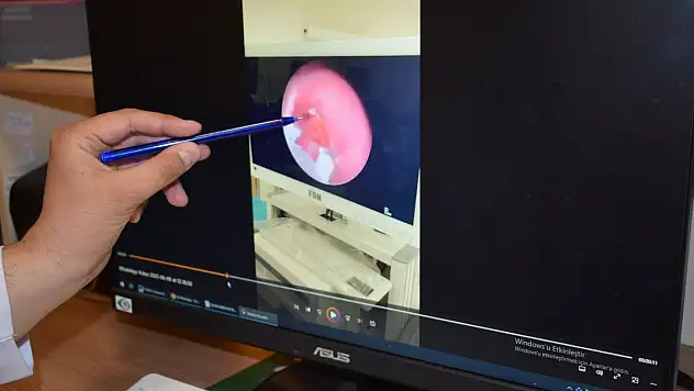 Şeker ambalajı bebeğin nefes borusuna kaçtı