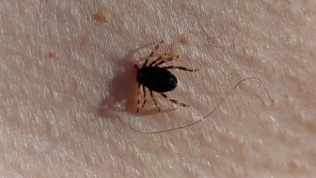 Kene kaynaklı 3 hastalığa dikkat